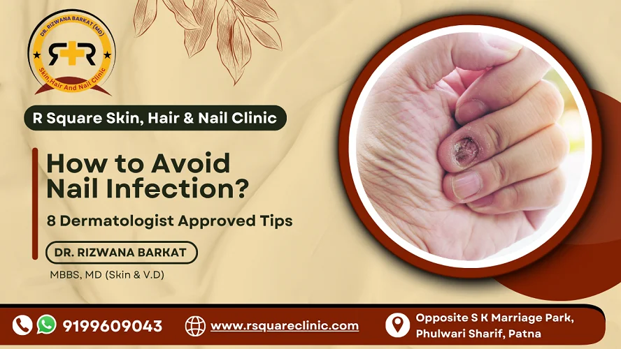 how to avoid nail infection