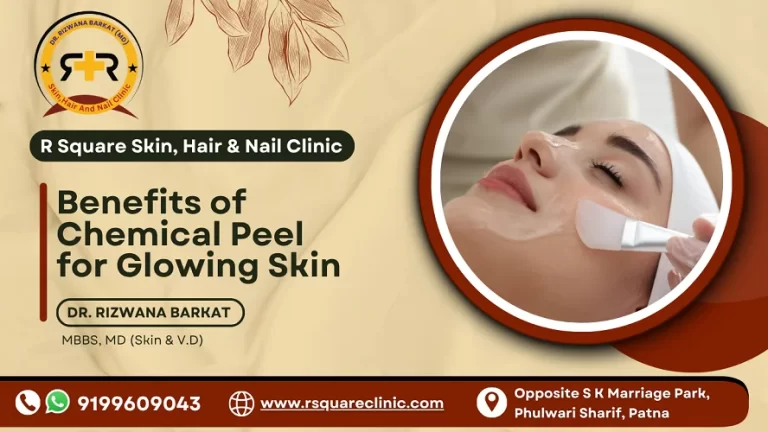 benefits of chemical peel