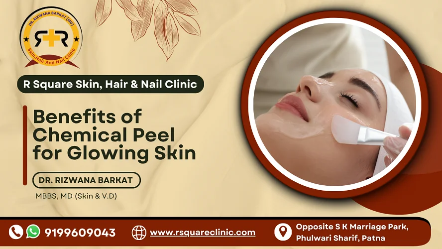 benefits of chemical peel
