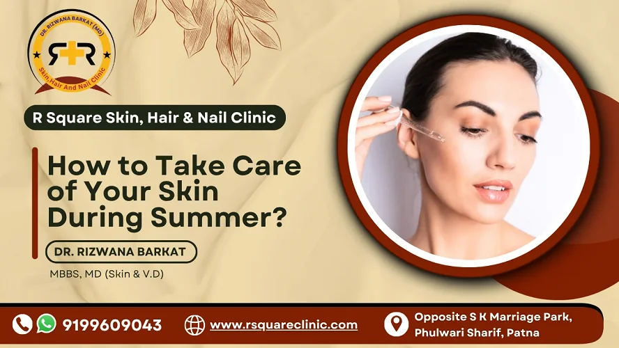 summer skincare tips