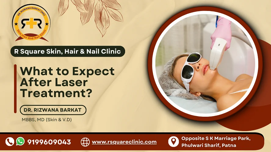 what to expect after laser treatment