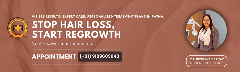 hair loss specialist in Patna