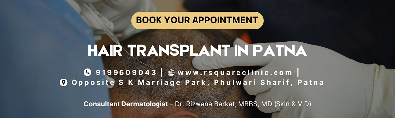 hair transplant in patna