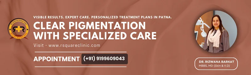 hyperpigmentation treatment Patna