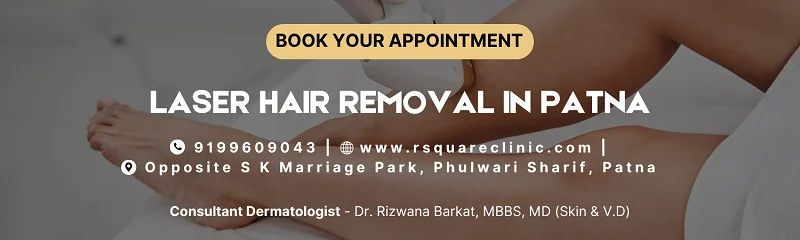 laser hair reduction in patna