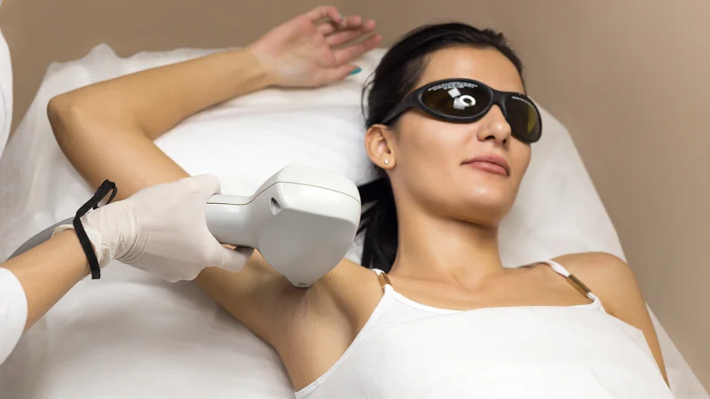 laser hair removal underarms