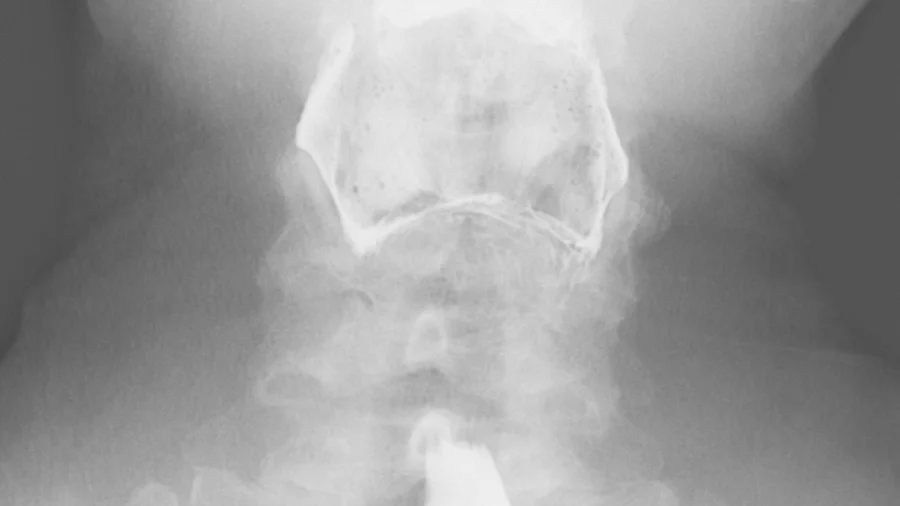 Barium tests