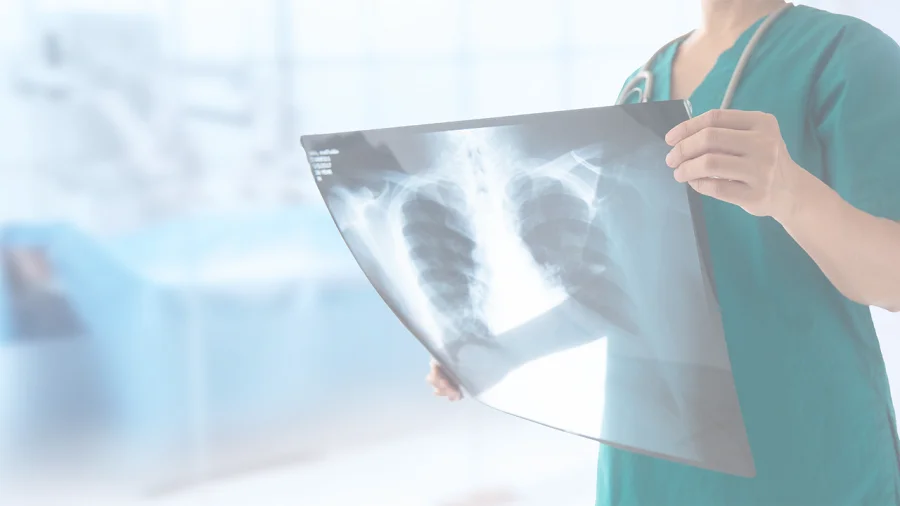 Digital X Ray
