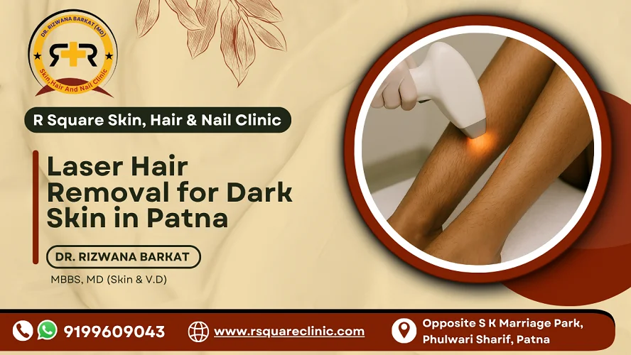 Best laser hair removal for dark skin