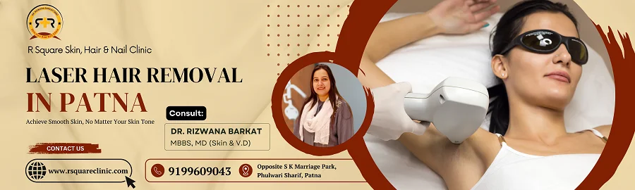 laser hair removal patna