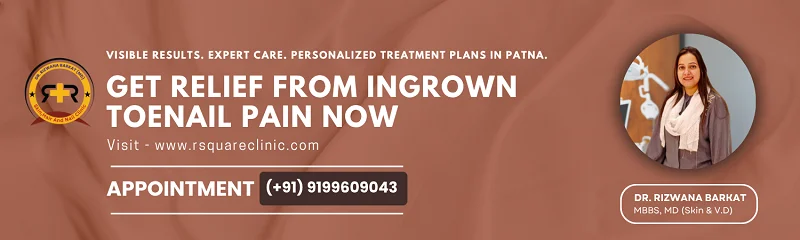 ingrown toenail treatment Patna
