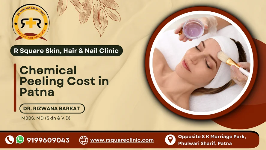 chemical peeling cost in patna