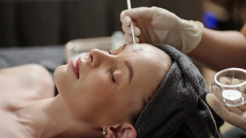 chemical peel price