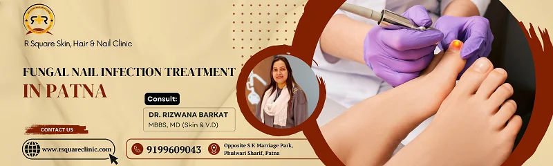best fungal nail treatment in Patna