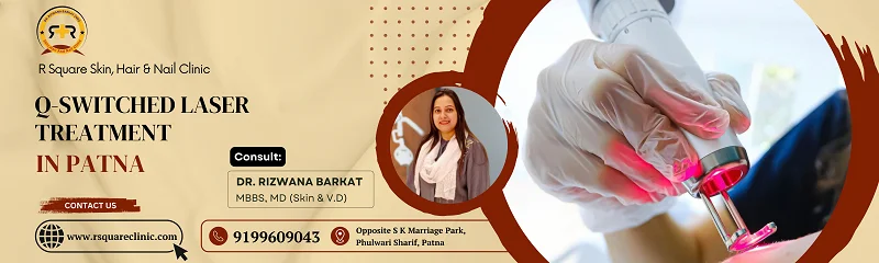 Book Q-Switched Laser Treatment