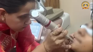 acne pigmentation removal R Square Clinic