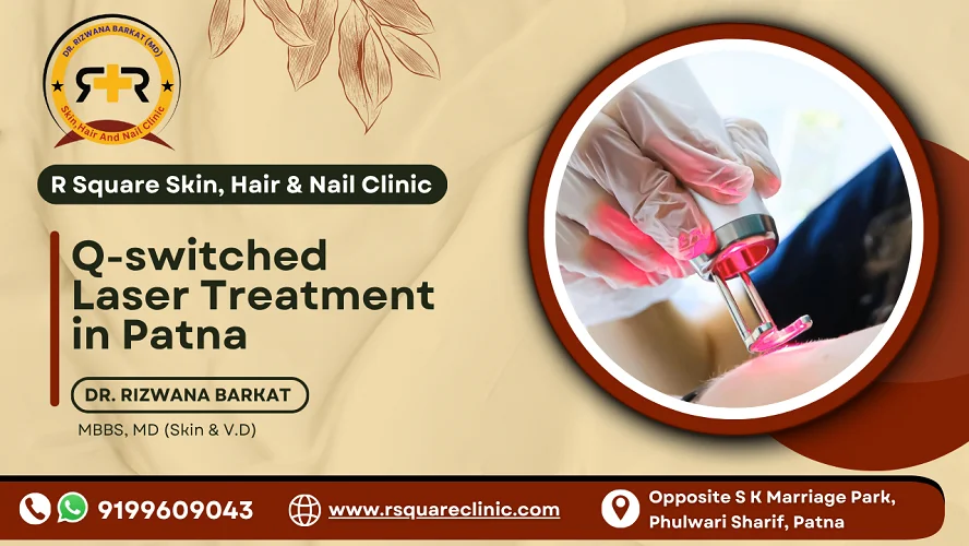 Q-switched laser treatment in Patna