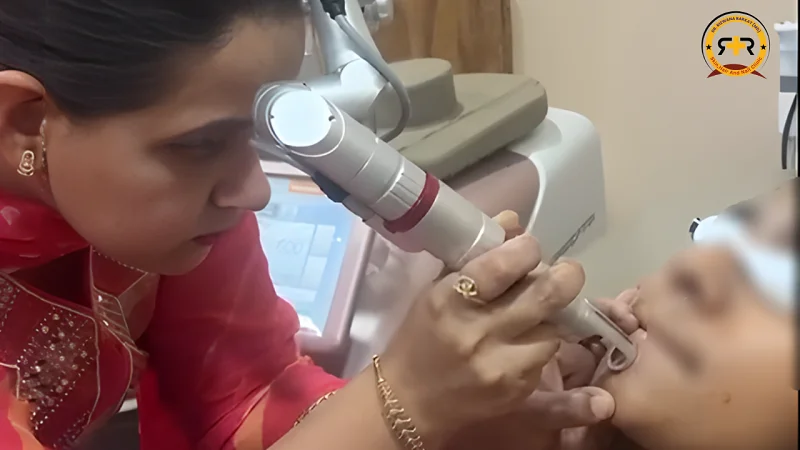 Q-switched laser treatment