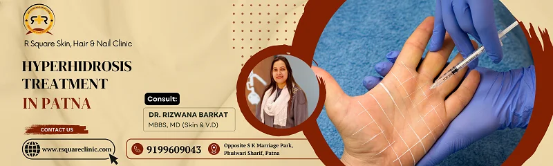 Treatment for Hyperhidrosis