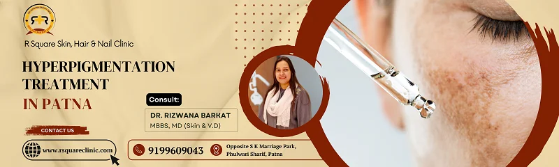 Winter hyperpigmentation treatment in Patna