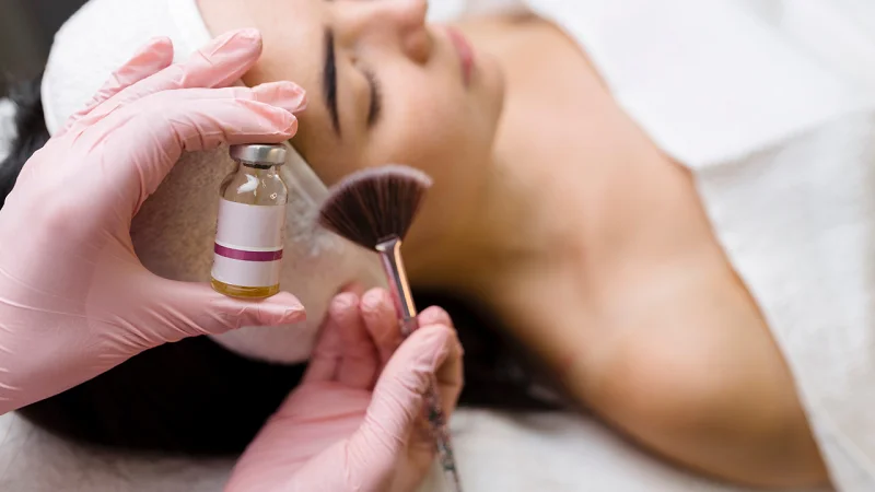 pigmentation treatment in Patna