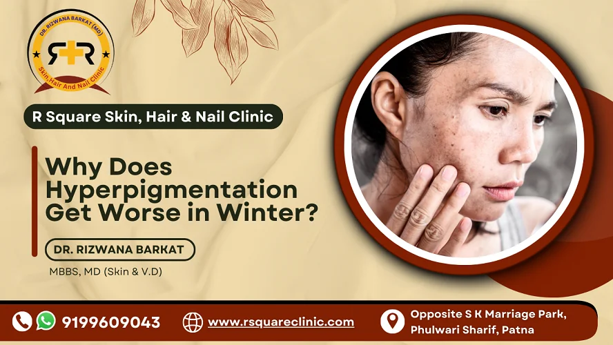 why does hyperpigmentation get worse in winter