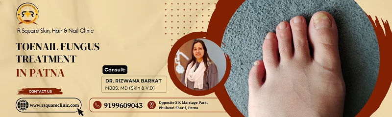 consult for toenail fungus