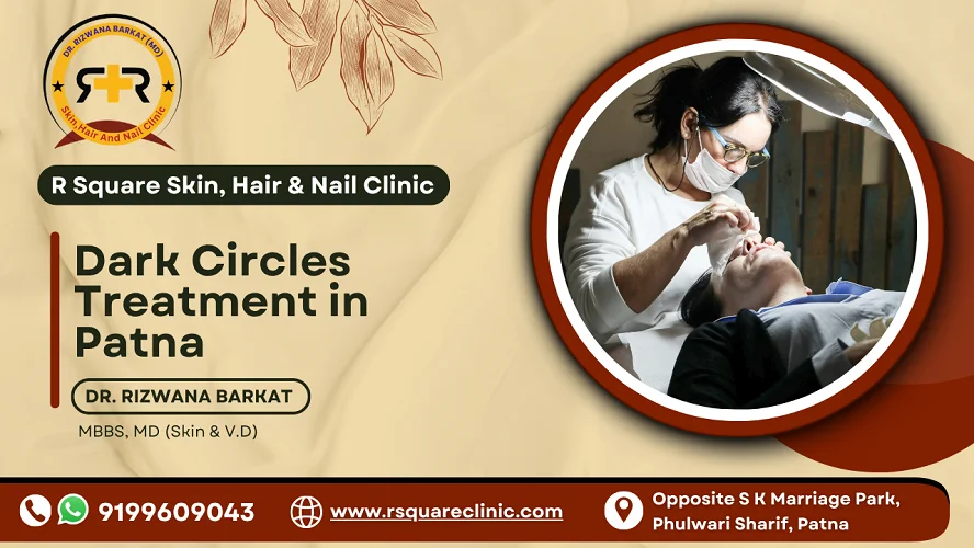 Dark Circles Treatment in Patna