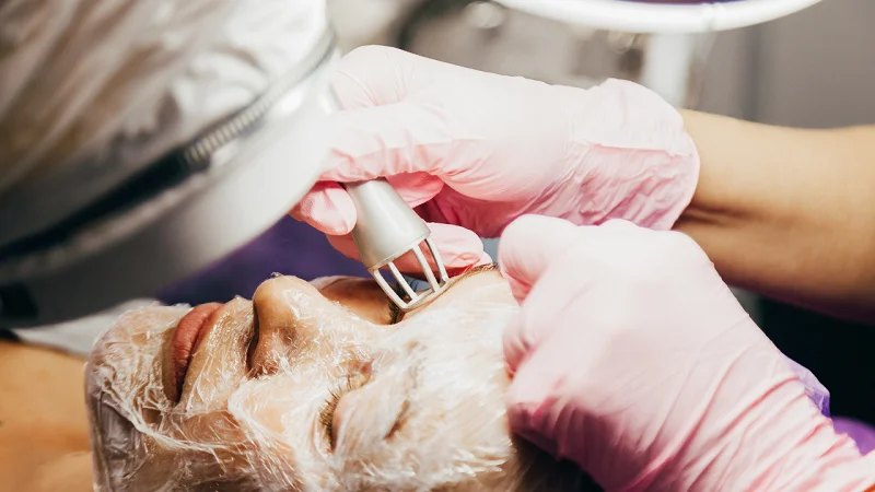 laser skin whitening treatment