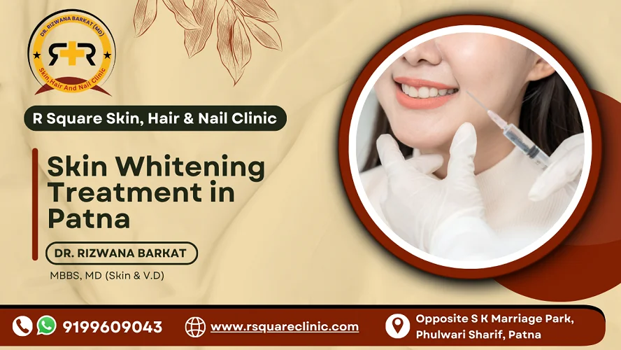 skin whitening treatment in Patna