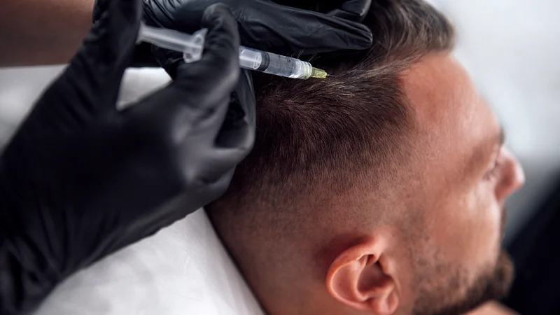 GFC vs PRP hair treatment review