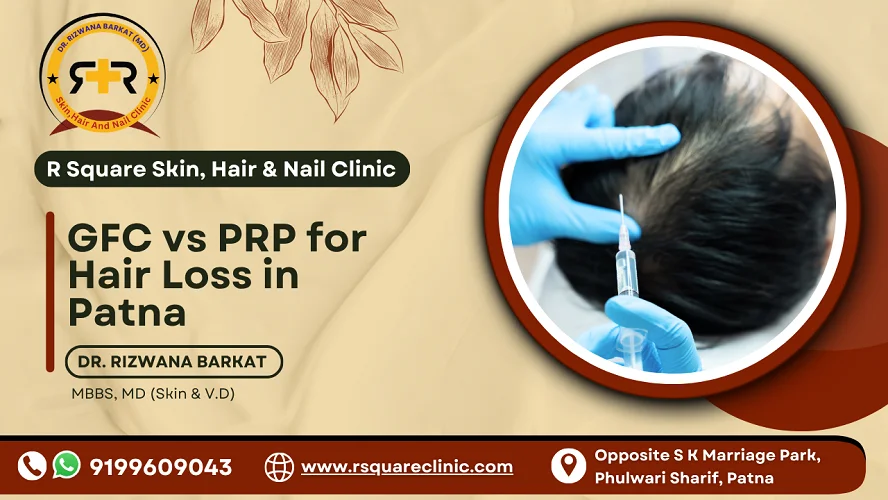 GFC vs PRP for hair loss in Patna