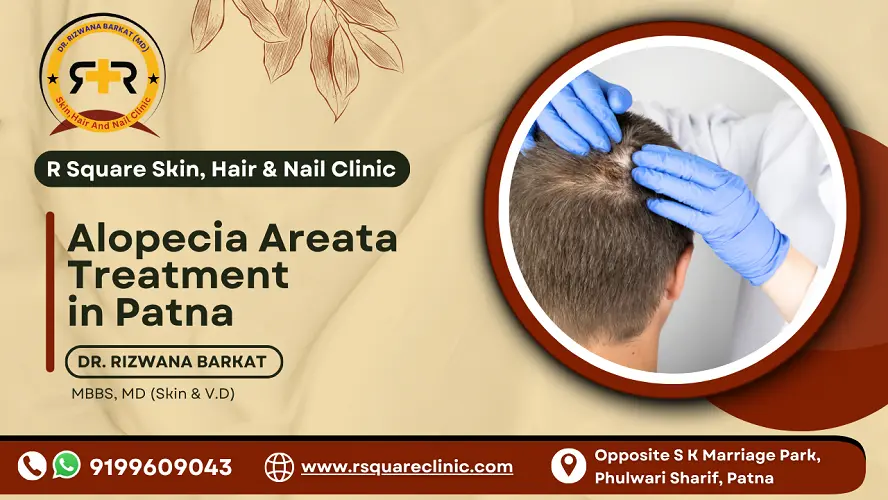 Alopecia Areata Treatment in Patna