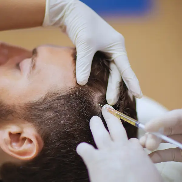 GFC Hair Treatment in Patna