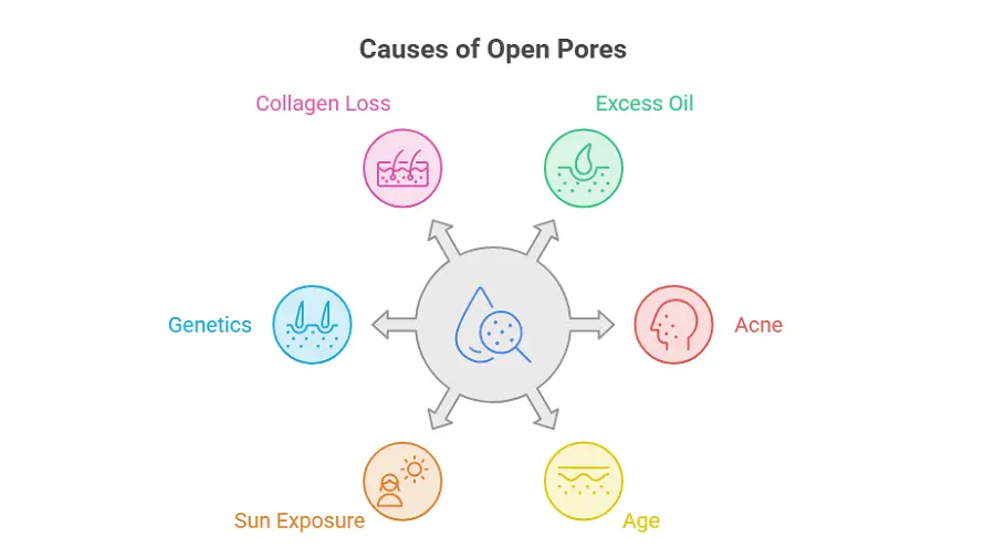 What Causes Open Pores