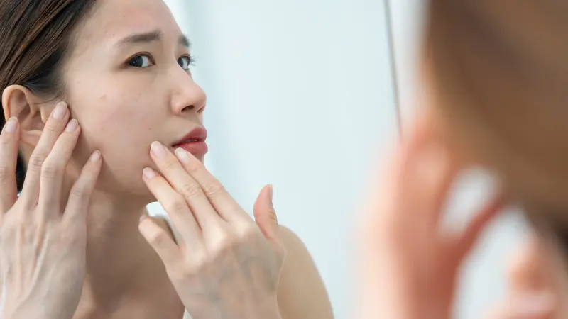 woman worried about open pores on face