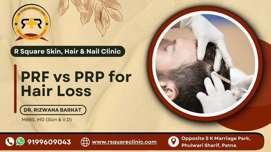 PRF vs PRP for Hair Loss