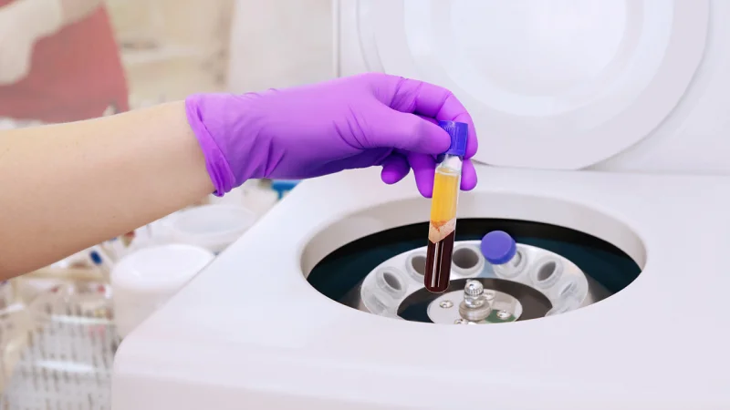 centrifugation PRP