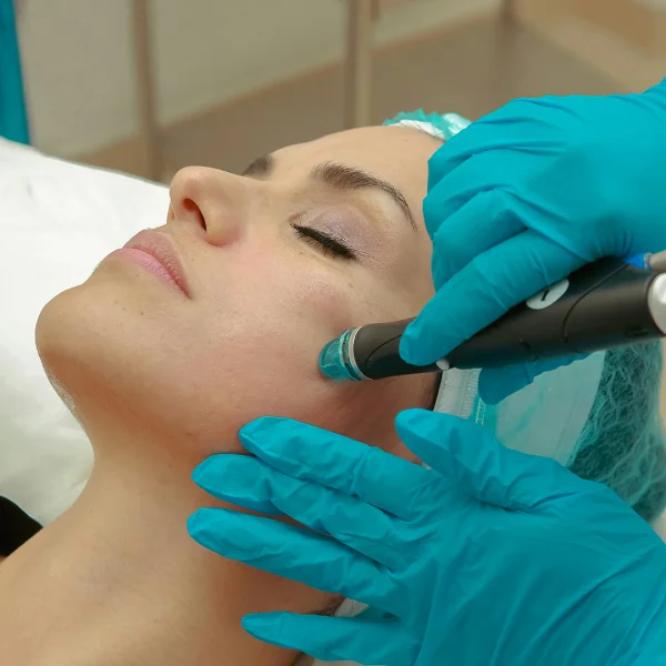 Hydrafacial in Patna