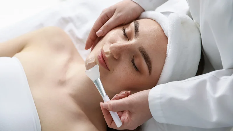 chemical peel application