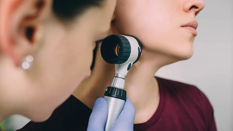 dermatologist with dermatoscope