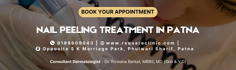 nail peeling treatment