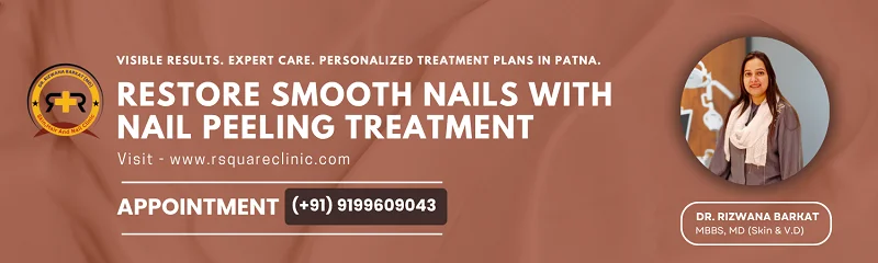 nail peeling treatment in Patna